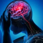 Headache and its management